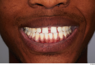 Kavan teeth 0001.jpg